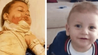 Help Mahmoud’s Son Heal From Burns